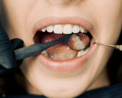 Periodontics vs General Dentistry