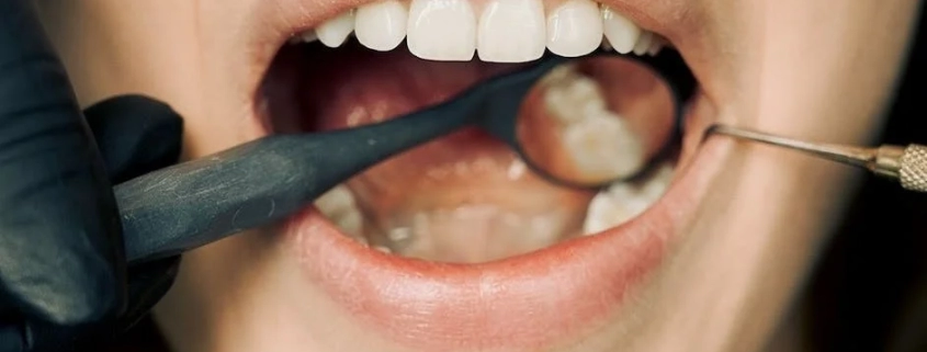 Periodontics vs General Dentistry